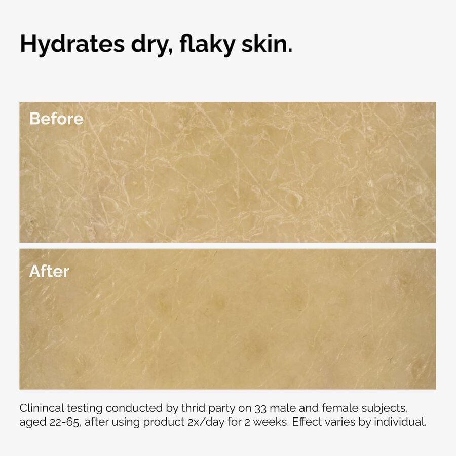 the-body-care-collection-s7 ord-natural-moisturizing-factors-inulin-body-before-after-graphic-02.jpg
