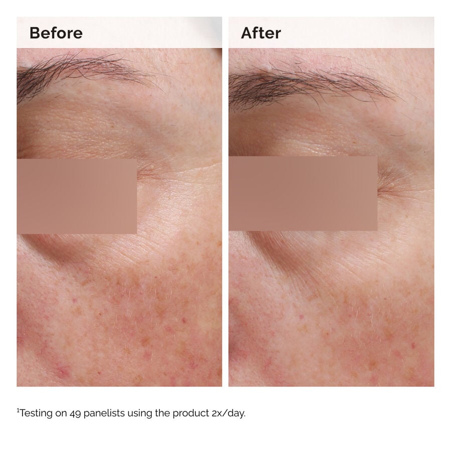 niacinamide-5-face-and-body-emulsion-v1 2024-08-23-ORD-Nia-5pct-Face-Body-B-A-Elasticity-Global-02-1x1.jpg