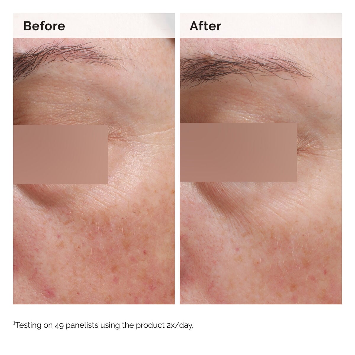 niacinamide-5-face-and-body-emulsion-v1 2024-08-23-ORD-Nia-5pct-Face-Body-B-A-Elasticity-Global-02-1x1.jpg