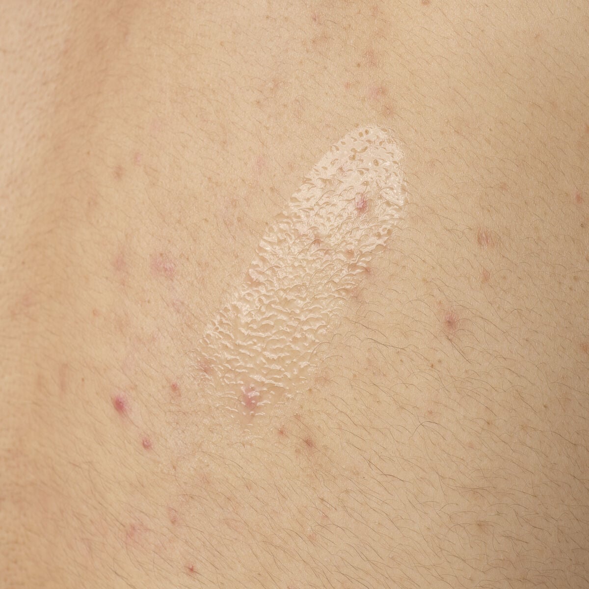 salicylic-acid-0-5-body-serum-s5 ORD-salicylic-acid-05-body-240ml-application.jpg