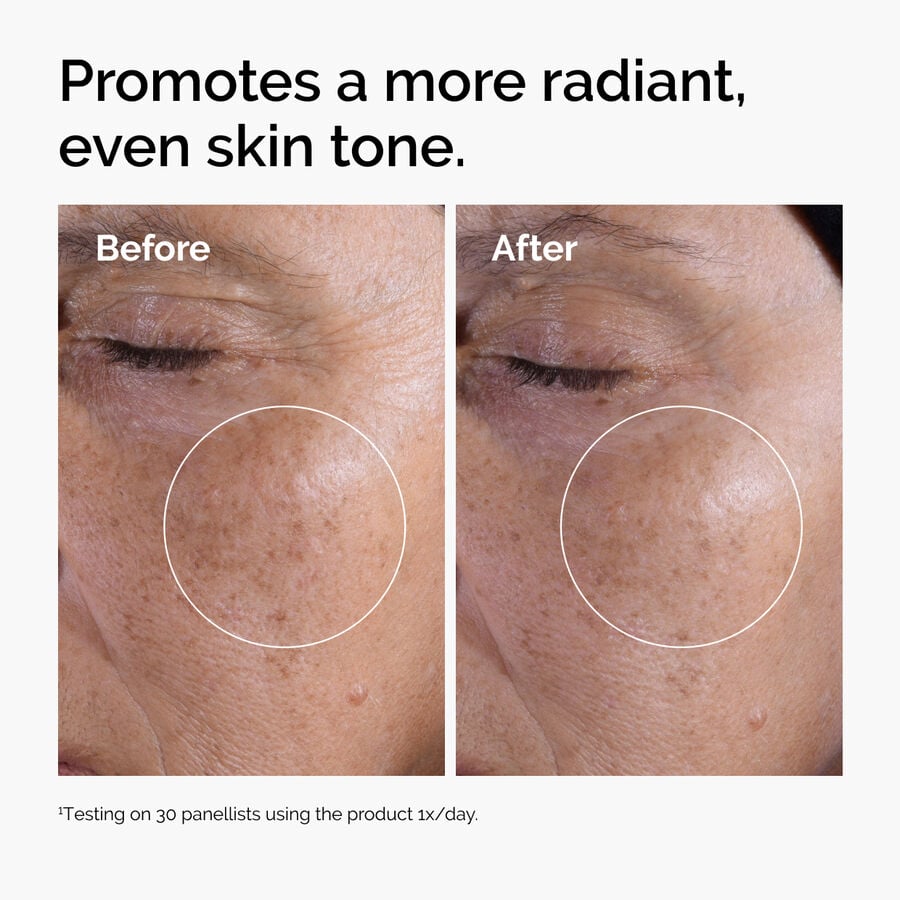 glycolic-acid-7-exfoliating-toner-k2 ord-glycolic-before-after-radiance.jpg
