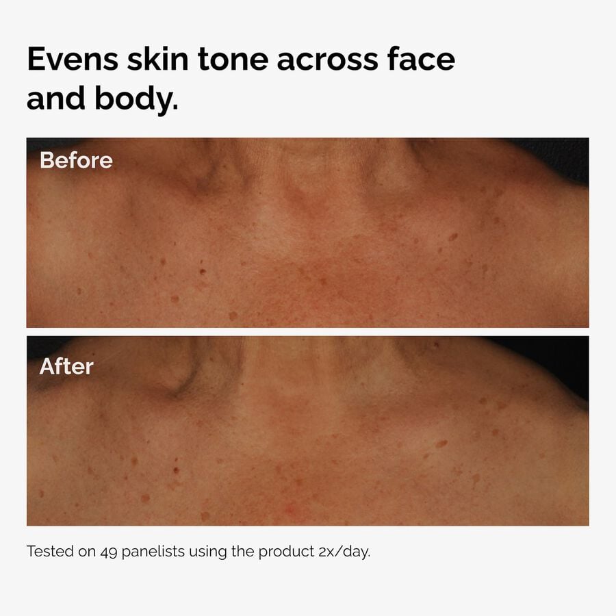 the-body-care-collection-s7 ord-niacinamide-face-body-serum-before-after-even-tone-graphic.jpg