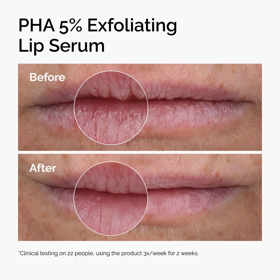 pha-5-exfoliating-lip-serum-c9 ord-pha-5pct-lip-exfoliating-serum-before-after.jpg