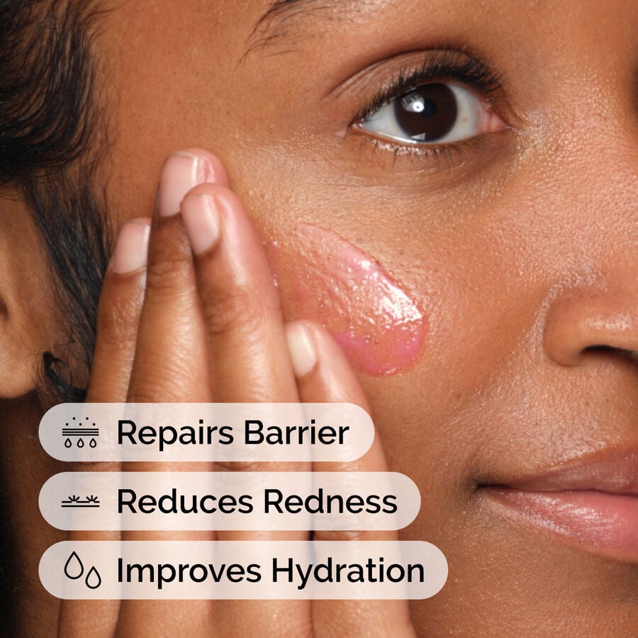 soothing-and-barrier-support-serum-set-j7 ord-soothing-barrier-support-serum-model-application-with-benefits.jpg